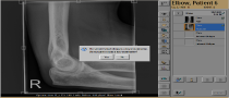 Adding an Image to a Completed Examination