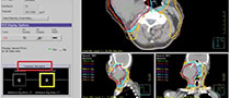 Radiation Oncology Education Pinnacle3 Webinar