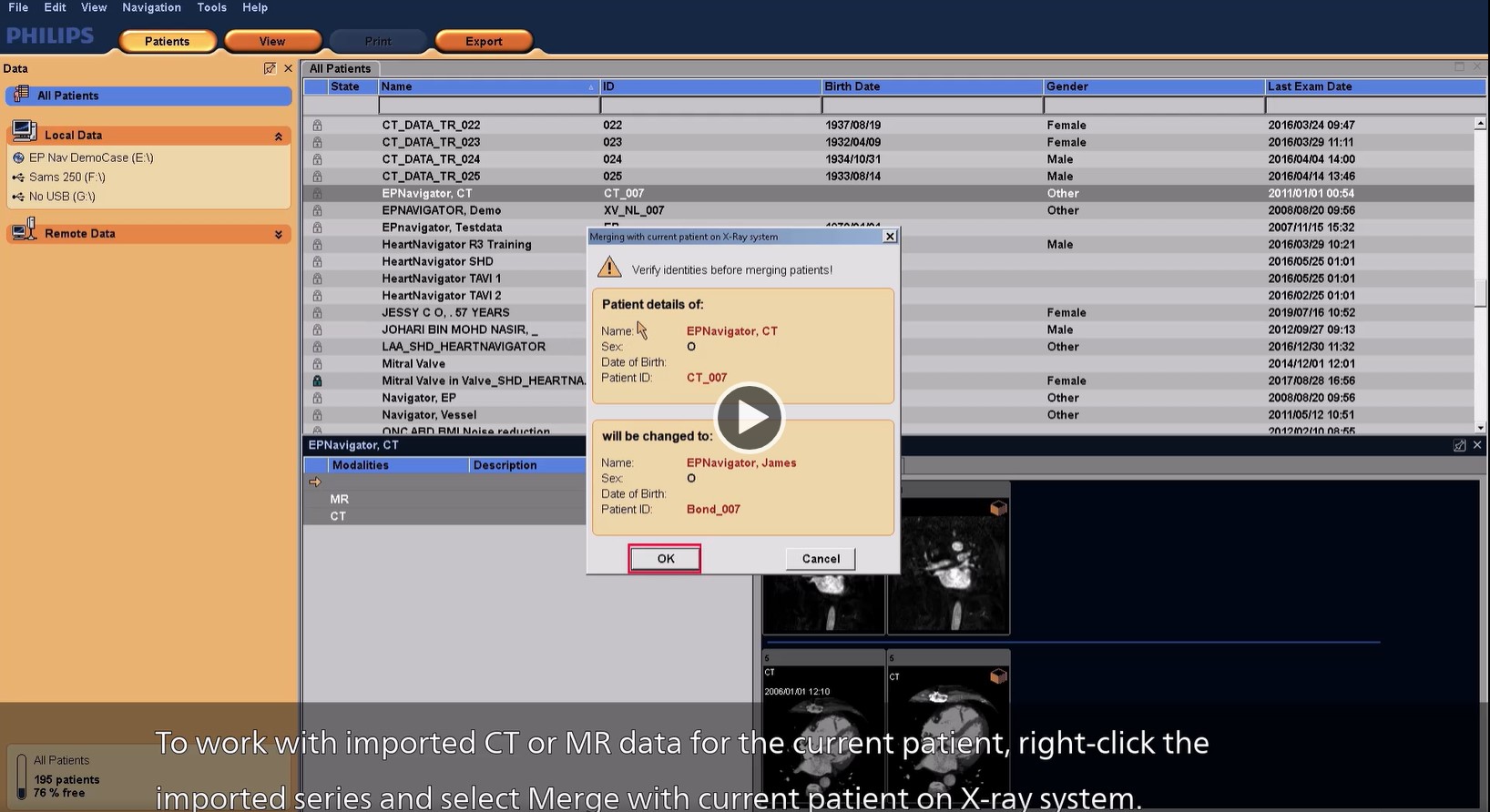 Importing CT or MR data