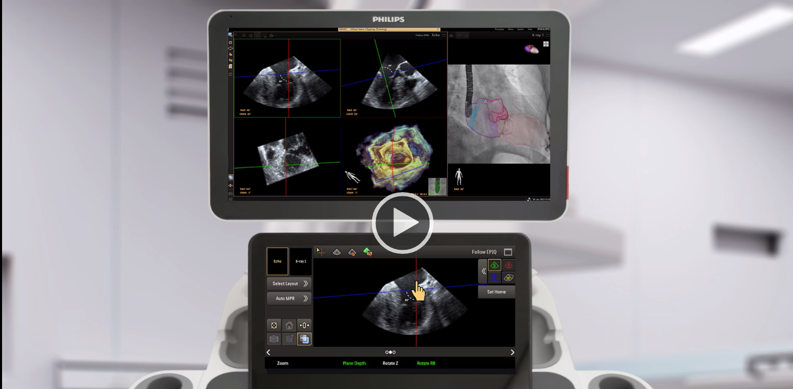 MultiVue interaction on the EPIQ touch screen